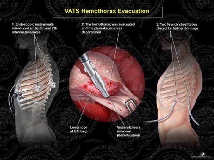 Does vats do more damage?